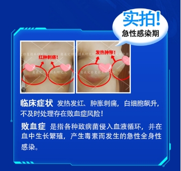 捷克水分子怎么取出