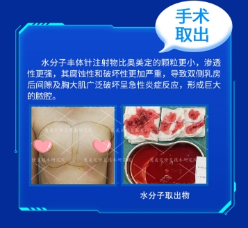 一位求美者的血泪自白：小吴在黑诊所经历的"捷克水分子"噩梦